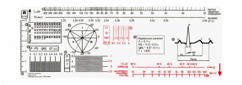 Инструкция как пользоваться линейкой. Линейка измерительная для ЭКГ (1/1) , Россия. ЭКГ-линейка Щучко. ЭКГ линейка Щучко измерительная для расшифровки электрокардиограммы. Шпаргалка по ЭКГ линейка.